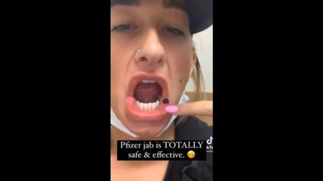 Girl Develops Blood Clots in her Mouth after getting the Pfizer Vaccine